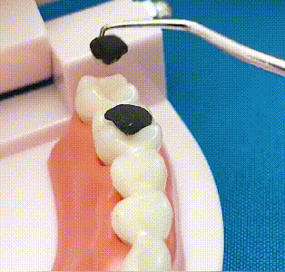 ✨Zestaw wykałaczek ze stali nierdzewnej🦷