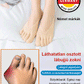 🧦Forró akció✨Uniszex láthatatlan korrekciós ötujjú zokni