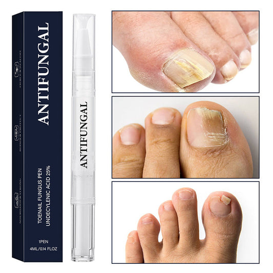 💅Körömgomba kezelő toll sérült körmökhöz